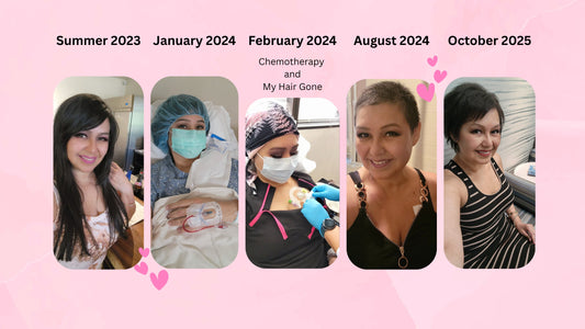 Chemo Took My Hair, But I Found Strength in Loss